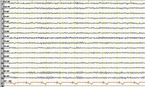 eeg_graph_1.jpg